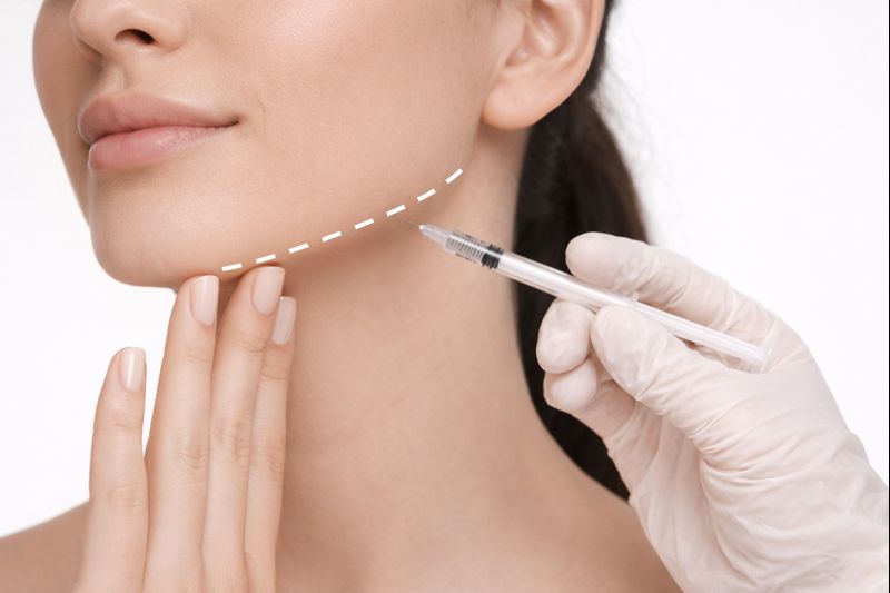 Perfilado mandibular